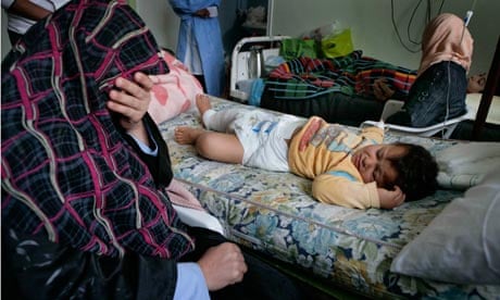 Injured child in Misrata