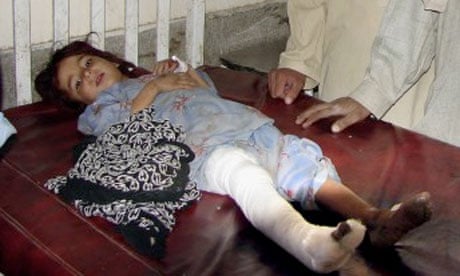 A six-year-old civilian victim of a US drone strike in Pakistan, 2009