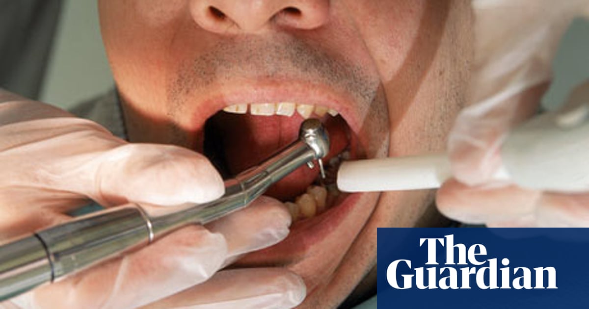 Diy Tooth Filling Kit Reviews - The 10 Best Teeth ...