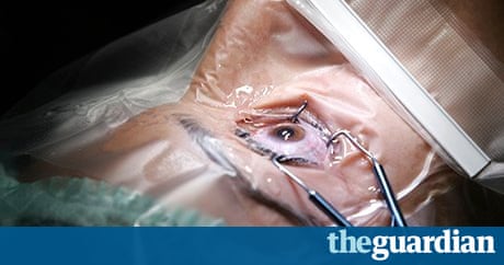 Brain Out Level 181 (Catch the doll) Solution – Puzzle ... Should I have laser eye surgery? | Money | The Guardian