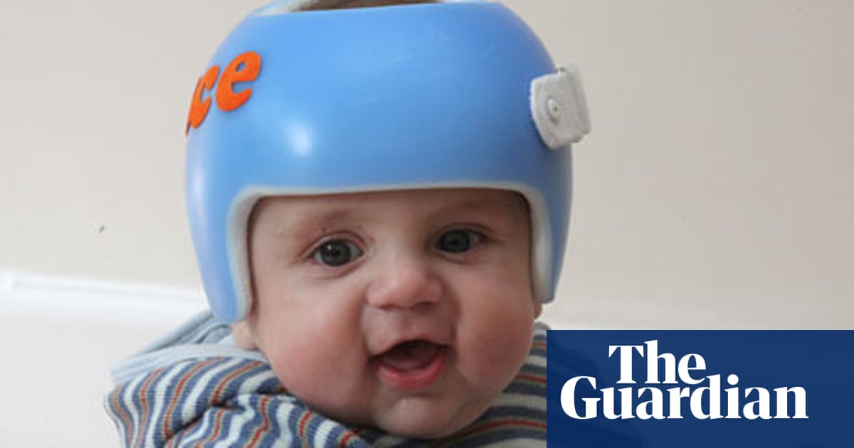 Doubts Over Helmet Cure For Flat Head Syndrome In Babies Consumer Affairs The Guardian Doubts Over Helmet Cure For Flat Head Syndrome In Babies Consumer Affairs The Guardian