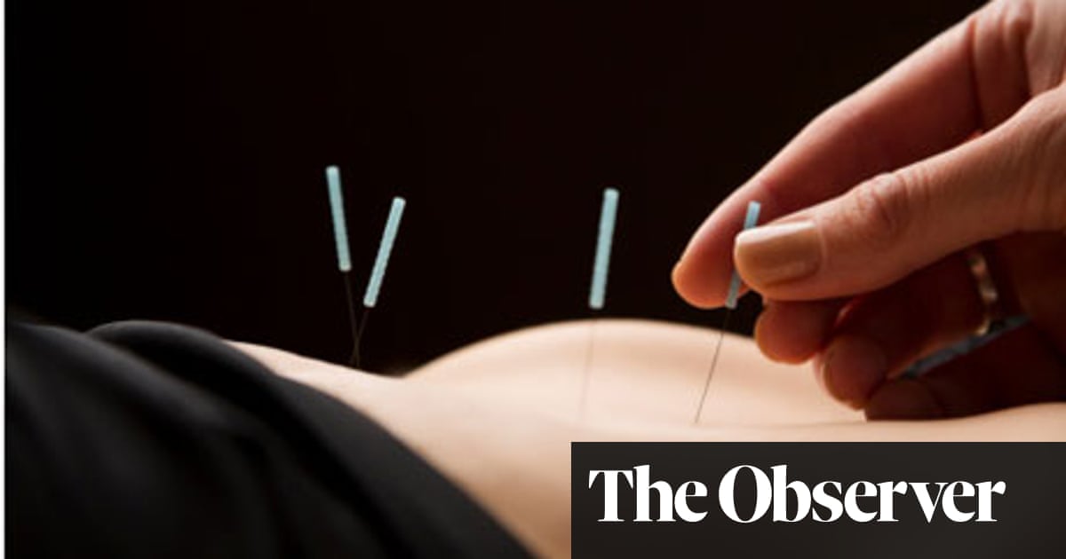 Acupuncture For Pain