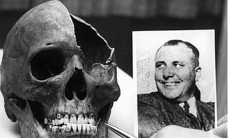 Martin Bormann skull