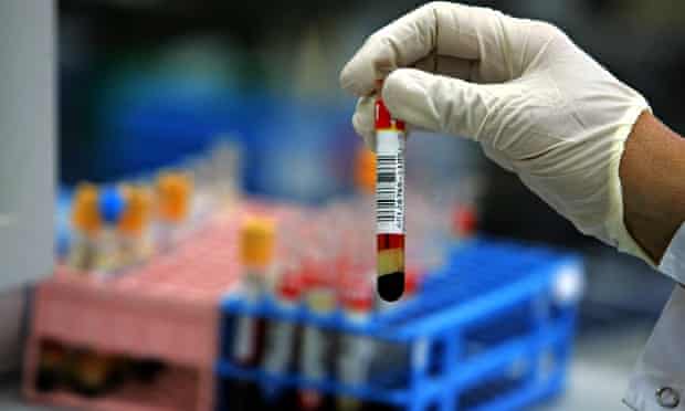 Hiv Tests And More What Men Stand To Lose If Planned Parenthood Is Defunded Planned Parenthood The Guardian Hiv Tests And More What Men Stand To Lose If Planned Parenthood Is Defunded Planned Parenthood The Guardian