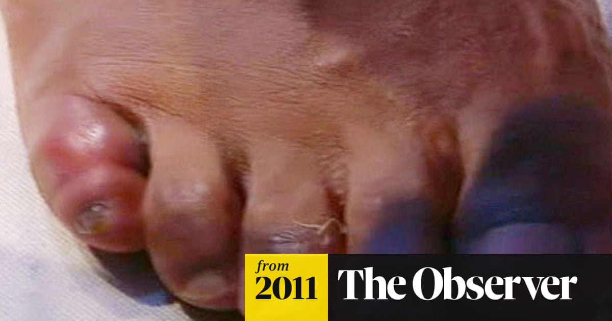 David Haye Loses Big Fight To Wladimir Klitschko But Blames Broken Toe David Haye The Guardian David Haye Loses Big Fight To Wladimir Klitschko But Blames Broken Toe David Haye The Guardian