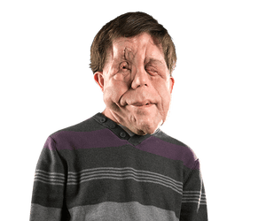 Disfigured Heroes Like Deadpool Help People Like Me Fight Prejudice Movies The Guardian Disfigured Heroes Like Deadpool Help People Like Me Fight Prejudice Movies The Guardian