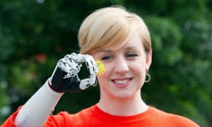 Nicky Ashwell poses for portraits at the offices of the London Prosthetic Centre, Kingston, west London.