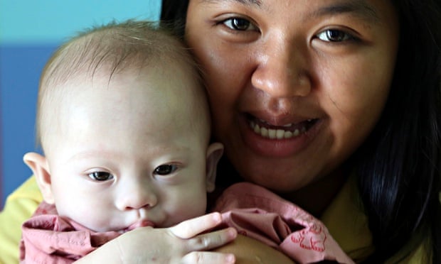 Baby Gammy and his mother